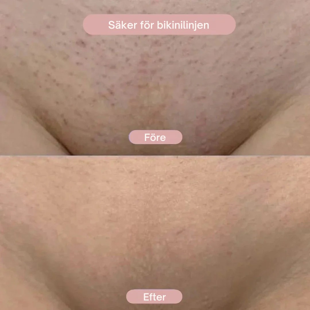 SilkyGlow Rakaparat 2-i-1 Din nya bästa vän i badrummet 🛁🧼🪒