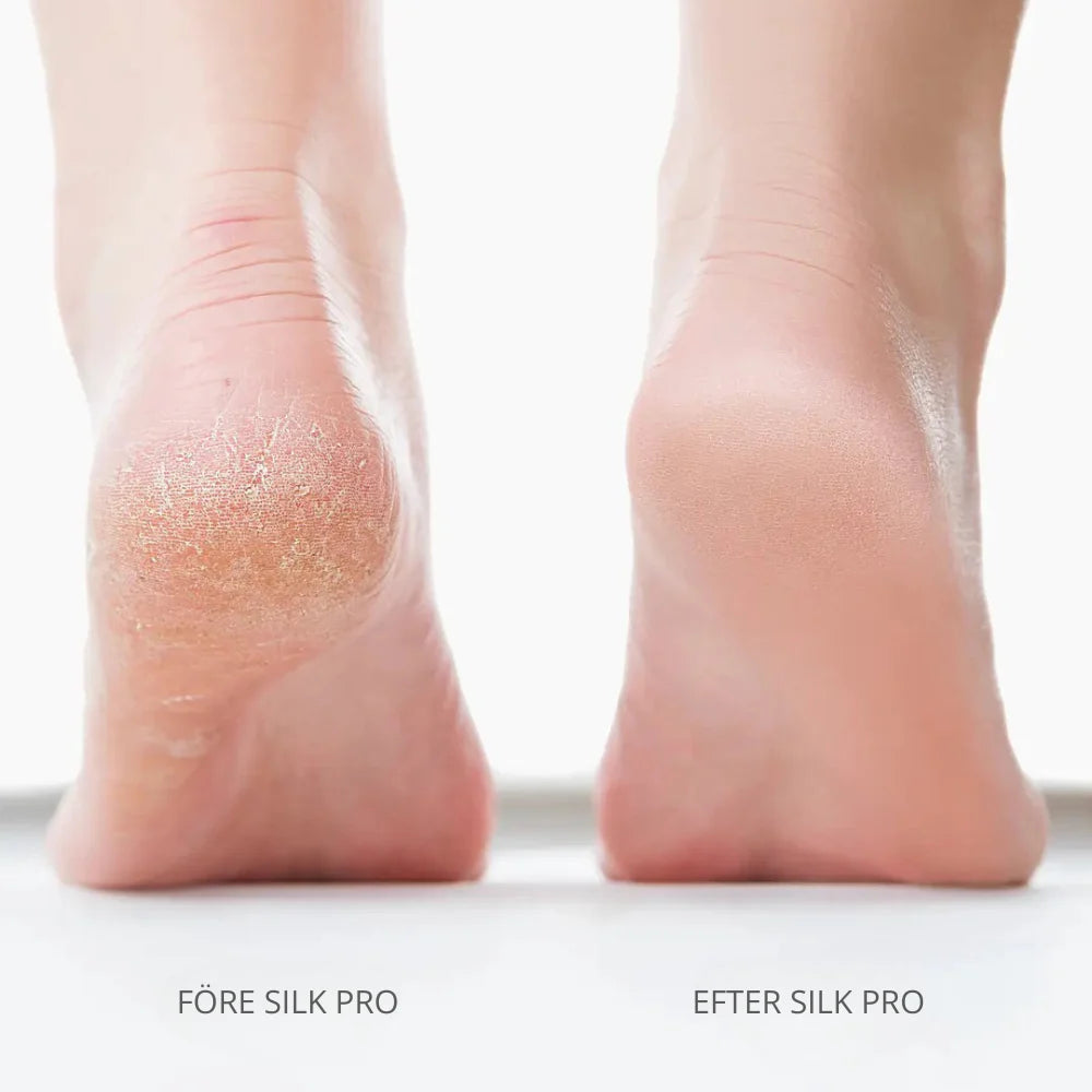 SmoothFeet Elektrisk Fotfil